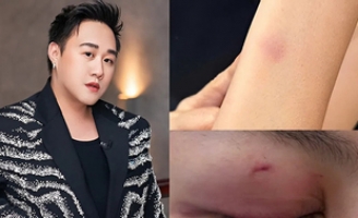 Cú trượt của Trung Quân